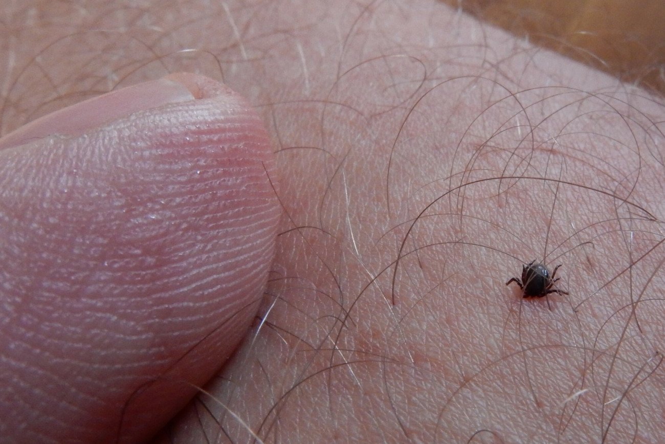 Badanie kleszcza czy biorezonans – to pieniądze wyrzucone w błoto. Tak nie diagnozuje się boreliozy.