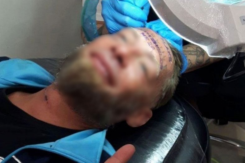 Polak za 100 funtów dał sobie wytatuować twarz. Zleceniodawcą był Anglik, który spędzał wieczór kawalerski.