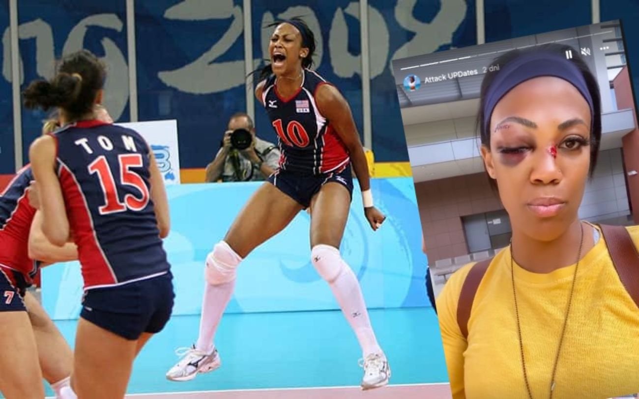 Siatkarka Kim Glass poważnie ranna, chwile grozy. Zaatakował ją bezdomny i uszkodził poważnie twarz