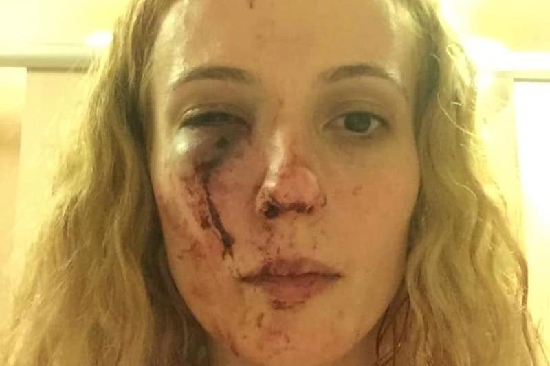 Rumunka brutalnie pobita w Doncaster. Napastnicy myśleli, że jest Polką.