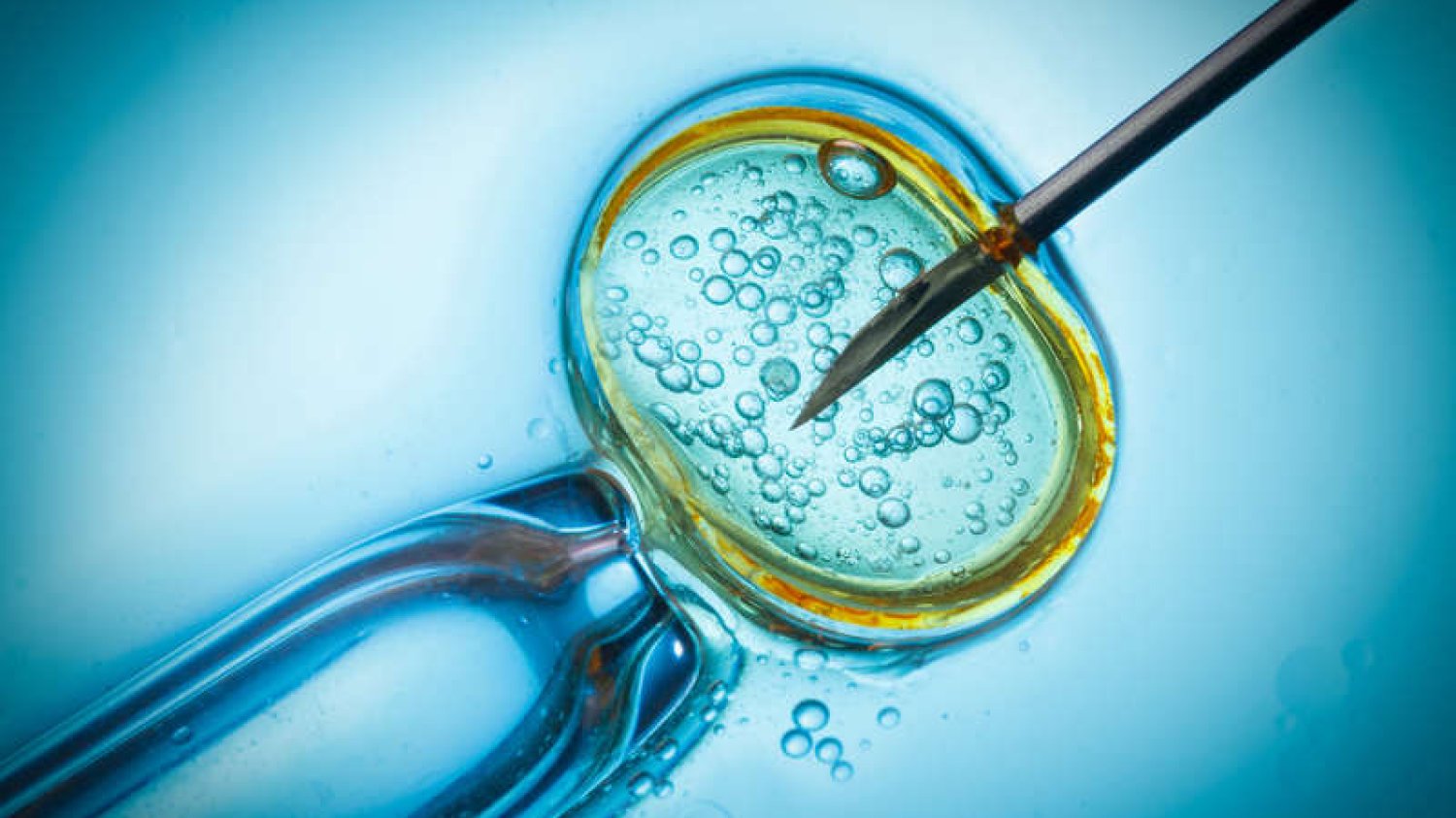 Projekt ustawy o in vitro już budzi kontrowersje - przez zapis o wyborze płci dziecka. "Nieprecyzyjny, doprowadzi do nadużyć"