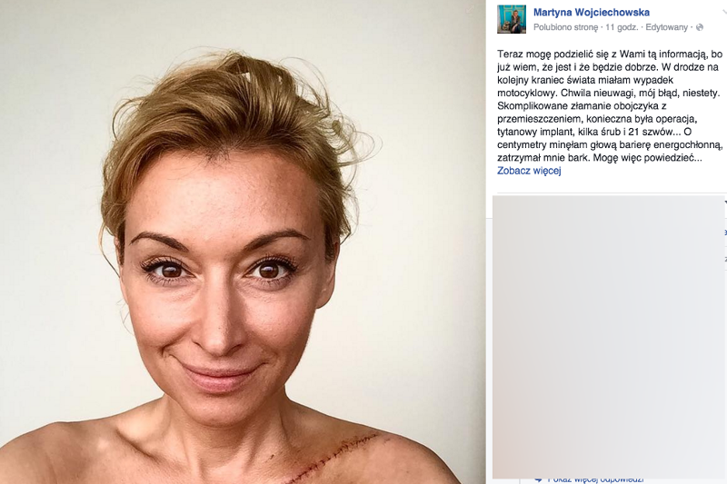 Martyna Wojciechowska miała wypadek