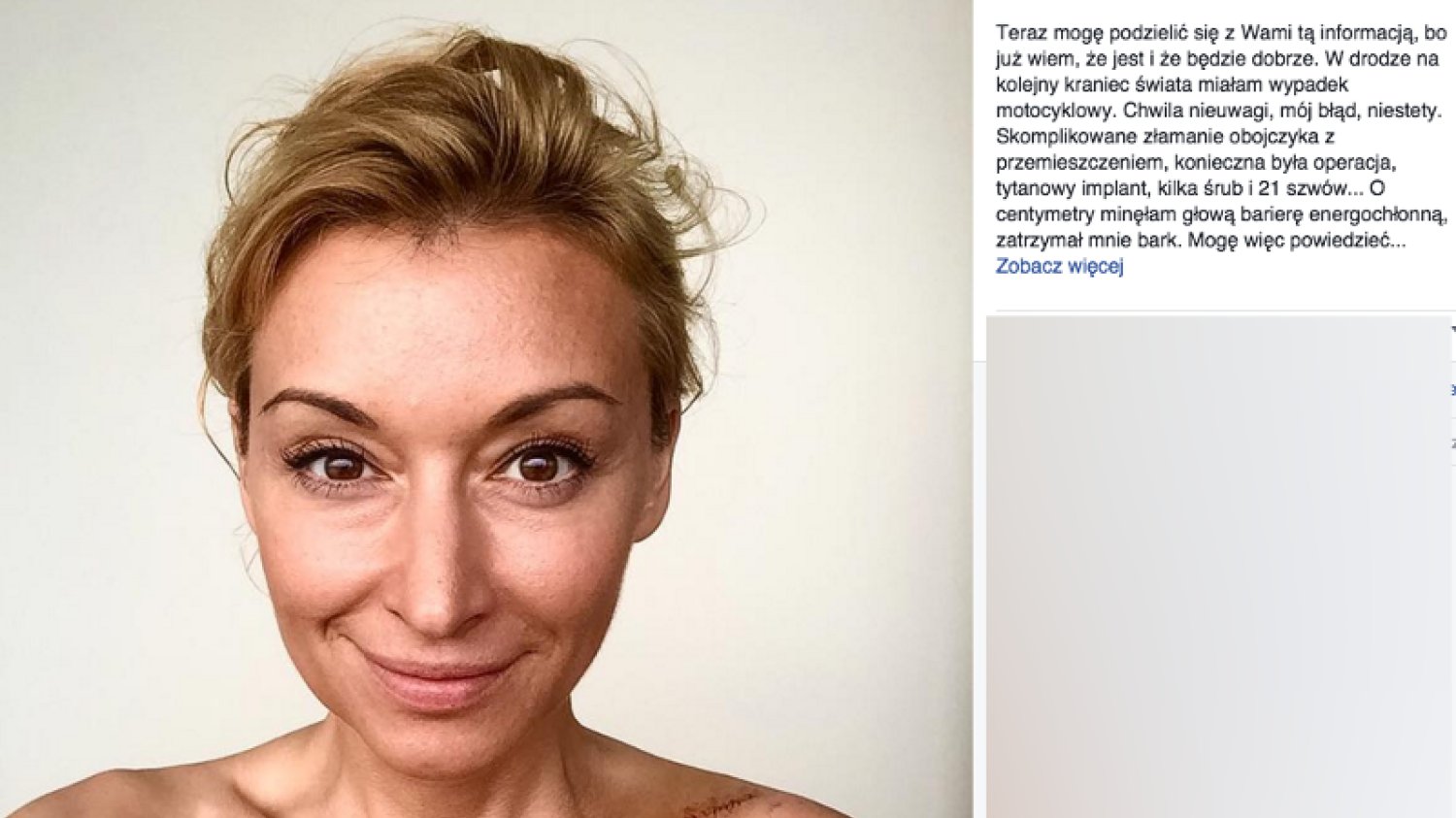 Martyna Wojciechowska miała wypadek