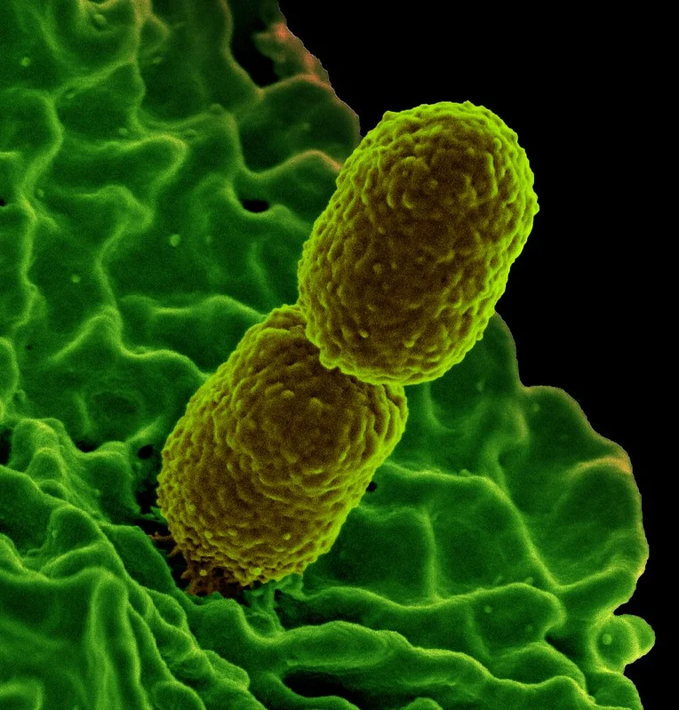 New Delhi (Klebsiella pneumoniae) – co to jest? Groźna bakteria w Rzeszowie