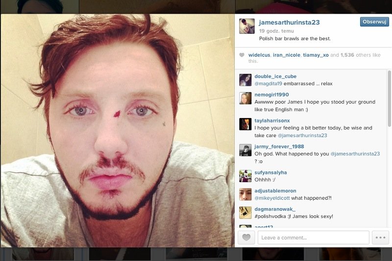 James Arthur został pobity w Polsce. "Bójki w polskich barach są najlepsze"