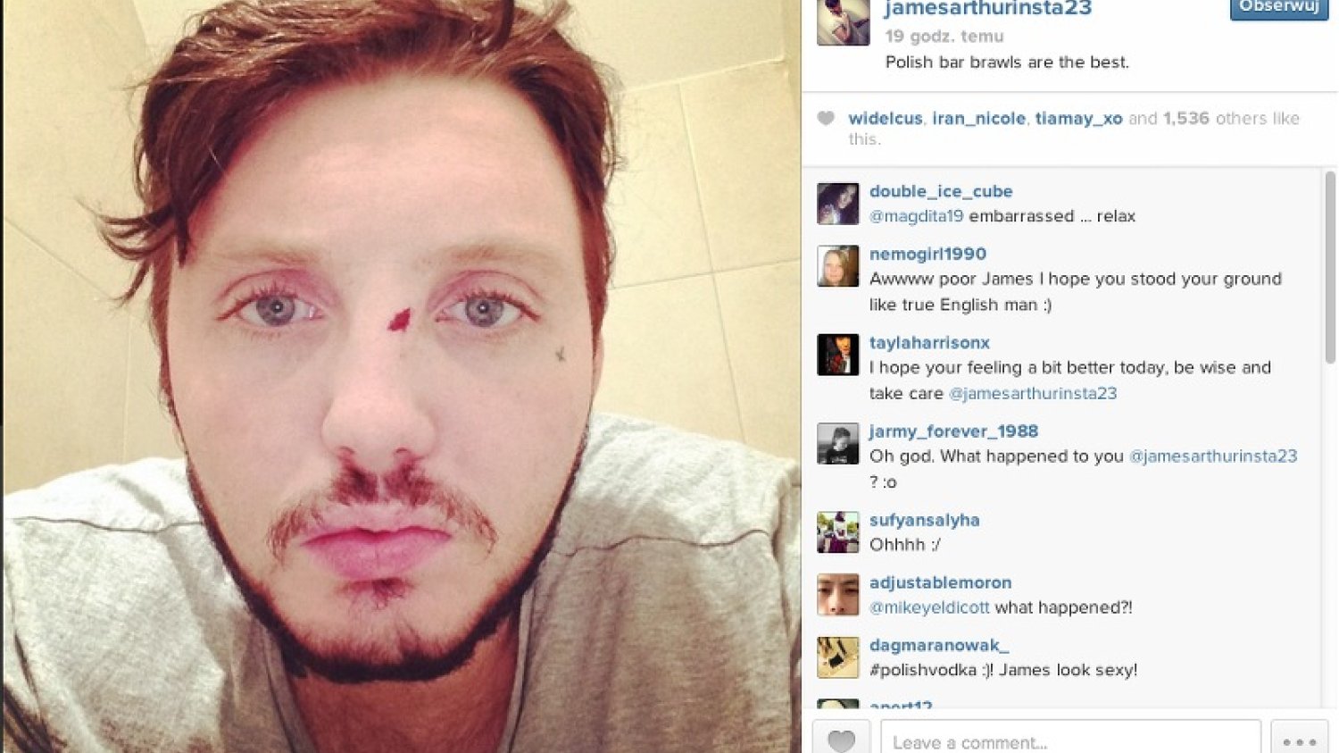 James Arthur został pobity w Polsce. "Bójki w polskich barach są najlepsze"