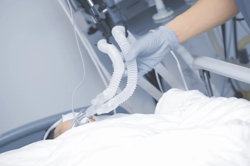W każdym kraju może zabraknąć respiratorów w przypadku wybuchu epidemii koronawirusa.