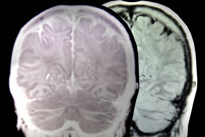 Nasze poglądy polityczne nie są zapisane w budowie mózgu - twierdzą specjaliści