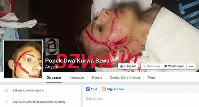 Fanpage Popek Dwa Kurwa Szwa