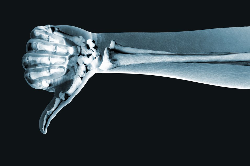 O problemach polskiej służby zdrowia rozmawiamy z lekarzem z jednego z zadłużonych warszawskich szpitali specjalistycznych.