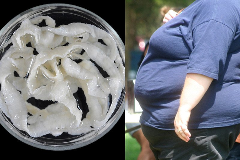 Chciała schudnąć, więc zjadła tasiemca. Zmarła z wycieńczenia. "Była szczęśliwa, bo straciła kilogramy"