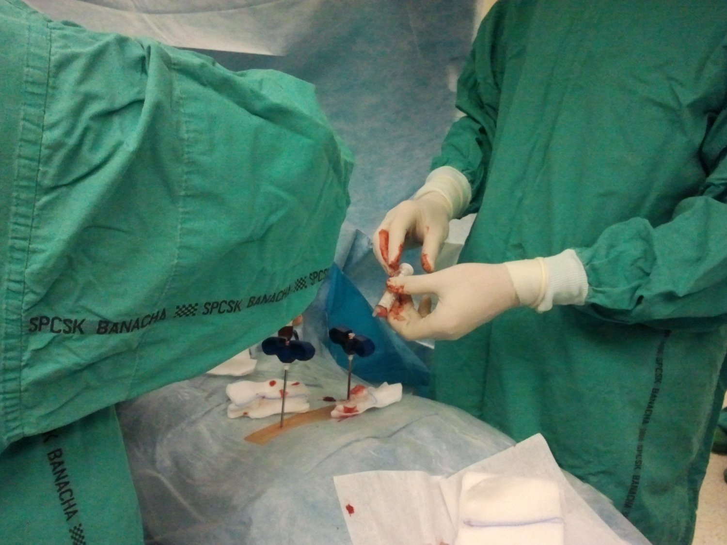 Pobranie szpiku z talerza kości biodrowej