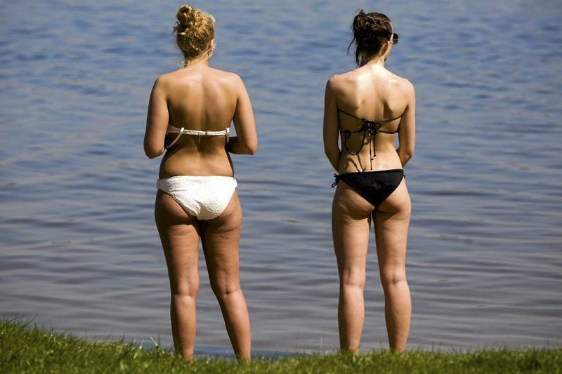 Słońce i bikini obnażają wiele niedoskonałości urody