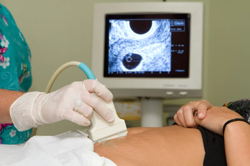 W Polsce nie ma aborcji? Jest, ale Polki wolą wyjechać na Słowację, do Niemiec lub Holandii. To żaden problem