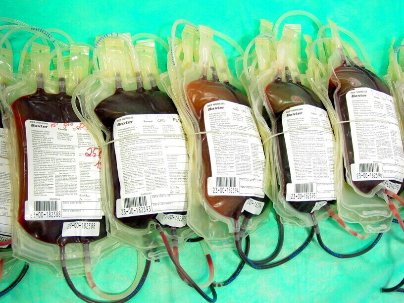 COVID-19 a grupy krwi. Naukowcy obalili popularny mit [NOWE BADANIA]