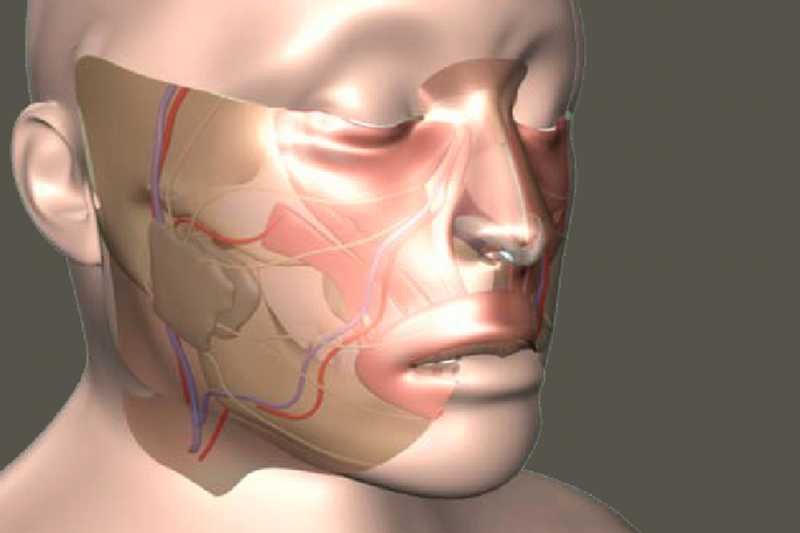 Graficzne przedstawienie przeszczepu twarzy