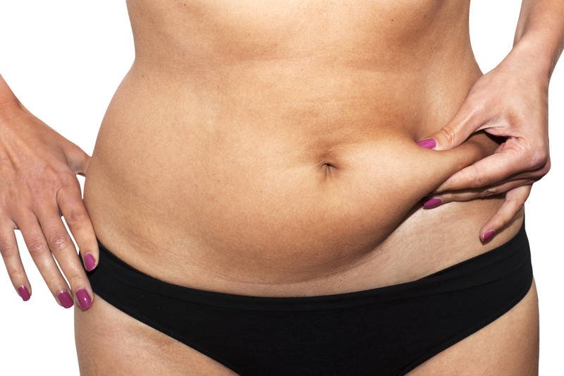 Problem z nadmiarem miejscowej tkanki tłuszczowej? Są na to sposoby