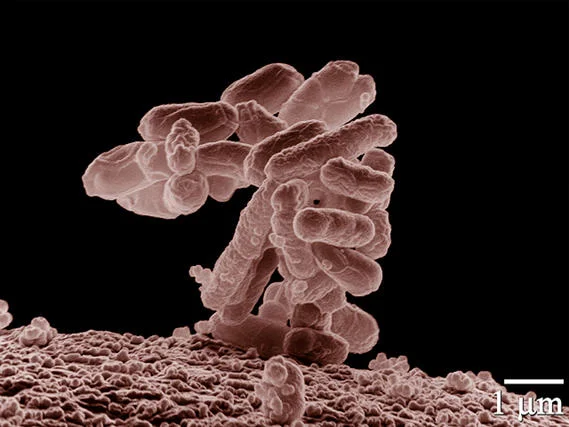 Bakteria e.coli wykryta w Mielnie, Unieściu, Sarbinowie i Ustroniu Morskim - w powiększeniu 10000 razy