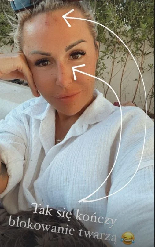 Blanka Lipińska miała wypadek.