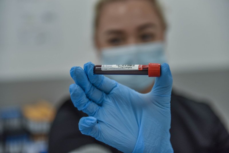 Czy amantadyna okaże się skuteczna na Covid?