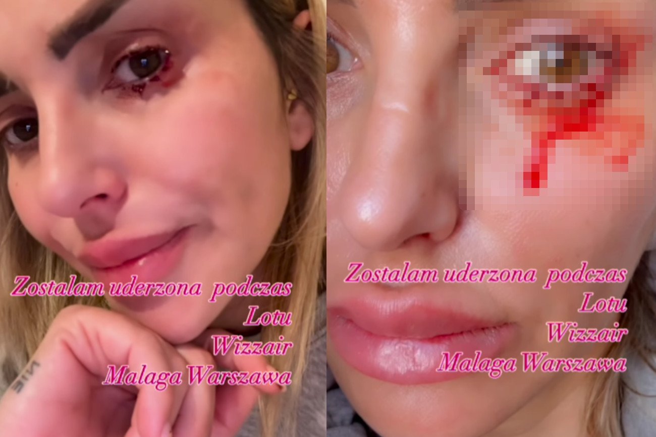 Monika Goździalska opowiedziała, że "została pobita w samolocie".