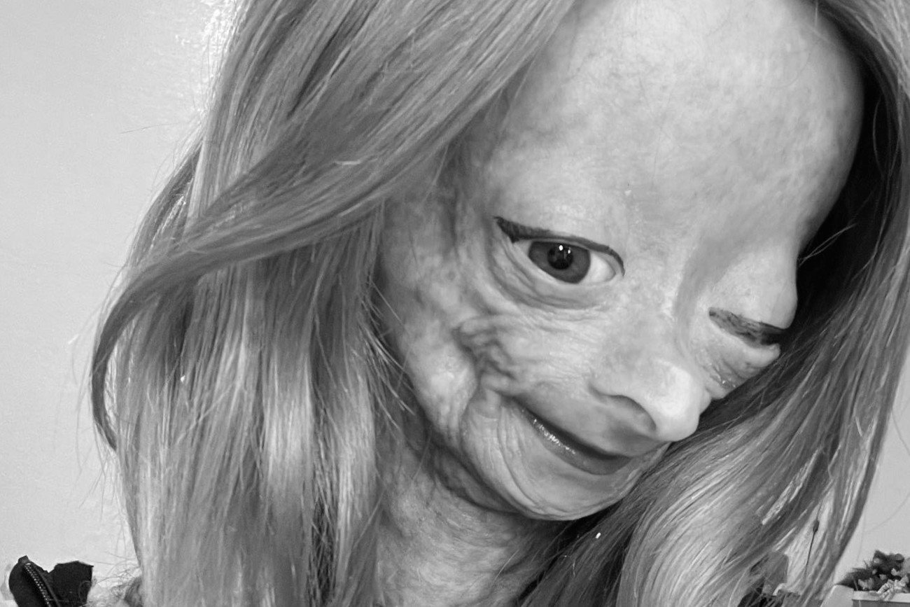 Adalia Rose
