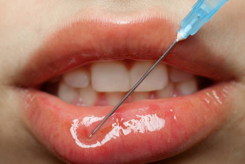 Czy duże zawsze znaczy piękne?