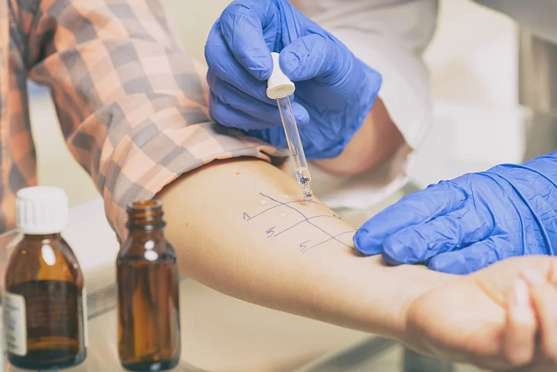 Przed podjęciem decyzji o rozpoczęciu immunoterapii alergenowej konieczne jest przeprowadzenie wnikliwych badań diagnostycznych obejmujących m.in. testy skórne