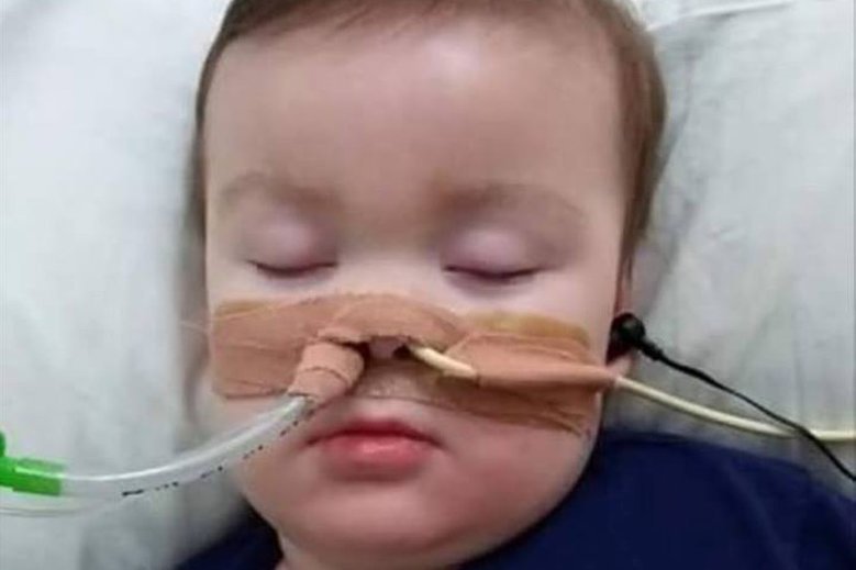 Alfie Evans zmarł w nocy z piątku na sobotę.