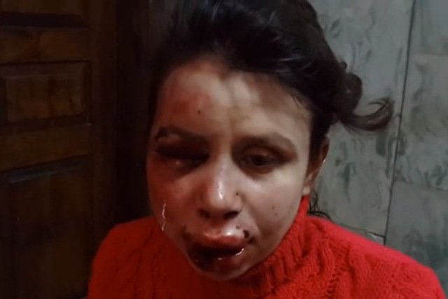 Tetiana Czornowoł została pobita w grudniu 2013 roku