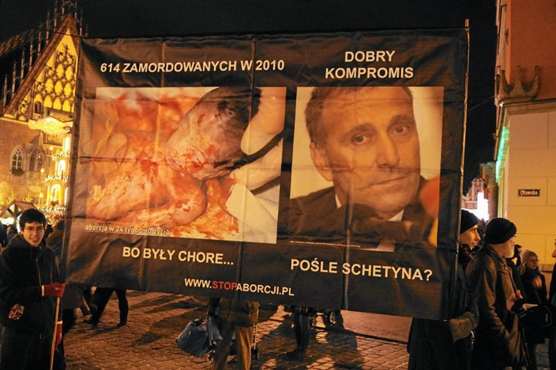 Fundacja PRO - Prawo do Życia chce piętnować posłów, którzy głosowali za aborcją eugeniczną