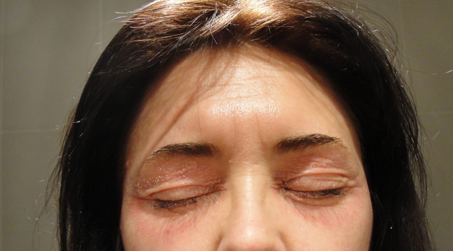 Sucha czy niedożywiona skóra?