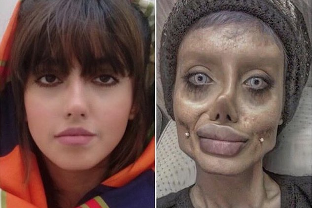Iranka Sahar Tabar jest nazywana "Zombie Angeliną Jolie"