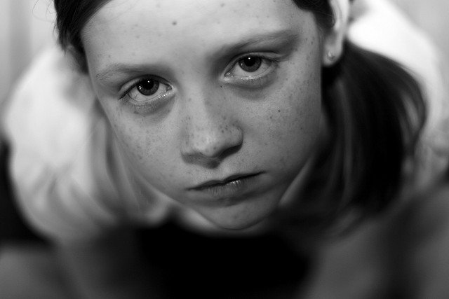 Znaleziono przyczynę guzów mózgu u dzieci.