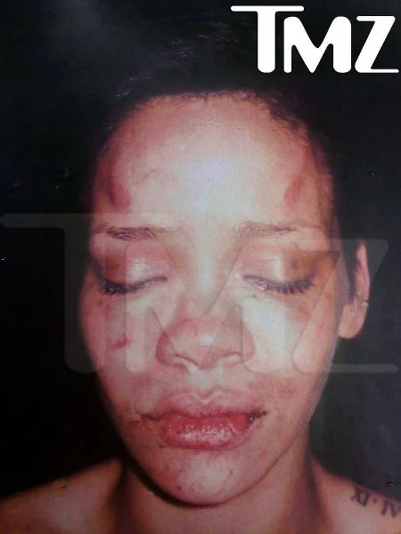 W 2009 r. świat obiegło zdjęcie Rihanny, którą pobił partner Chris Brown