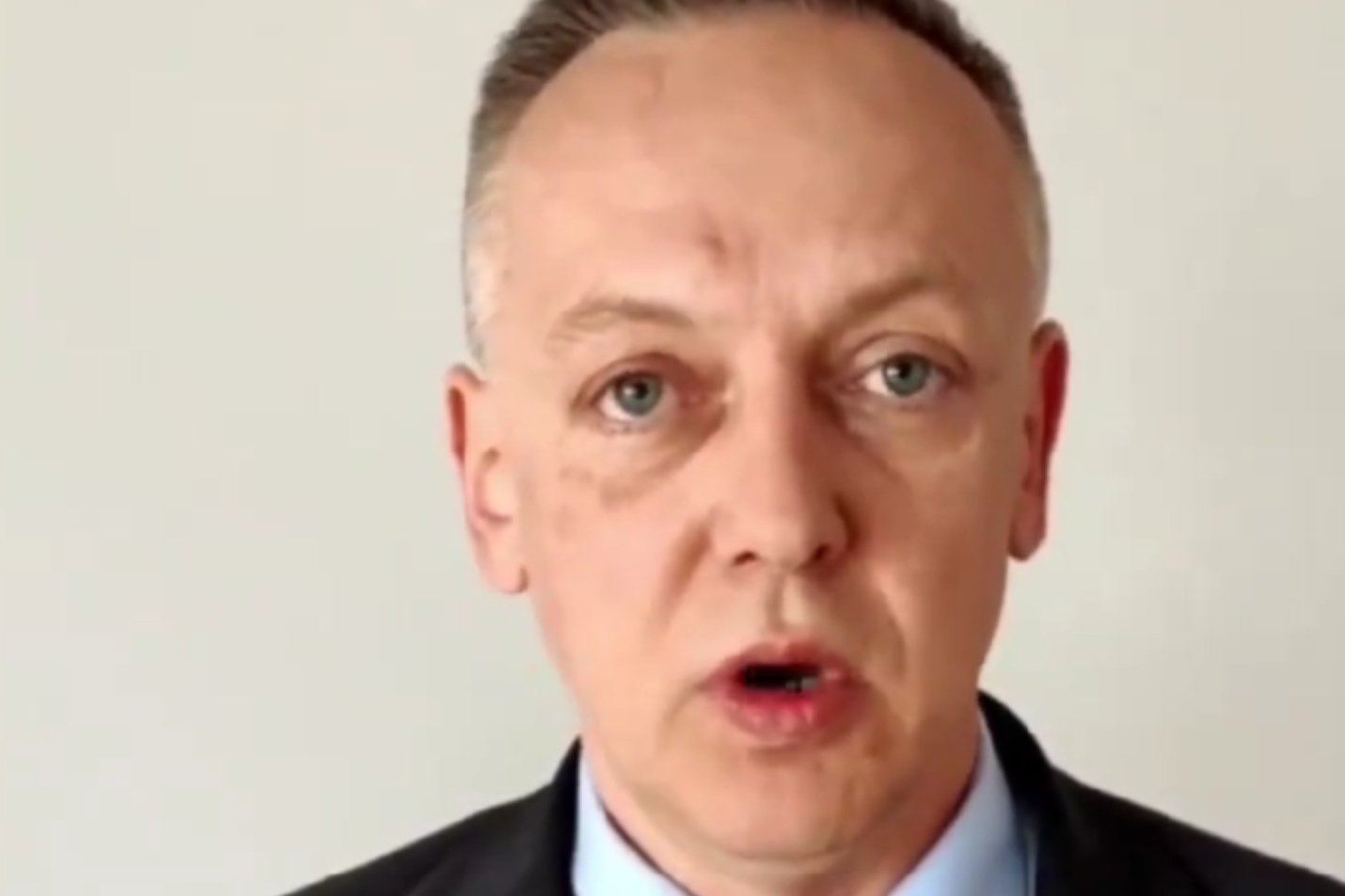 Jest nowe nagranie Szmydta z Białorusi. Ludzie pytają, co z jego twarzą.