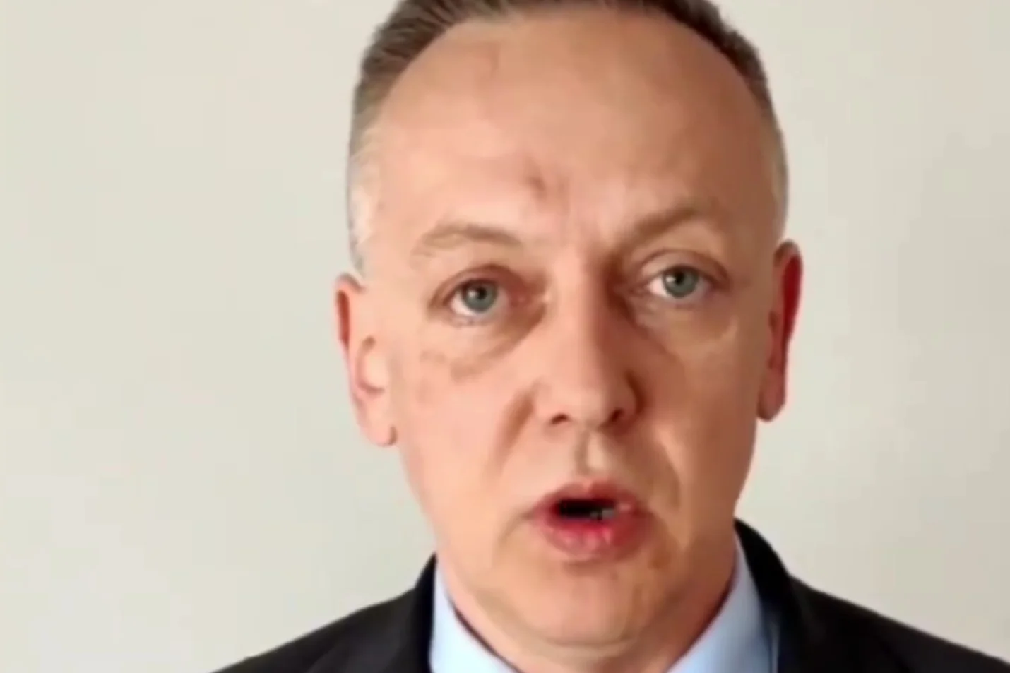 Jest nowe nagranie Szmydta z Białorusi. Ludzie pytają, co z jego twarzą.