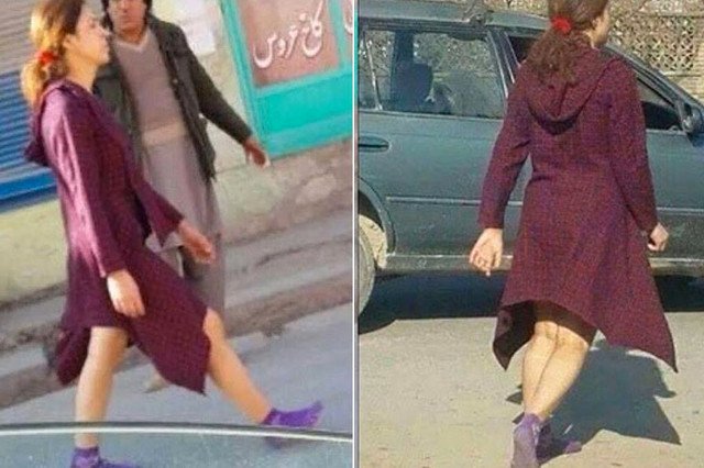 Kobieta, która wyszła na ulice Kabulu z odsłoniętymi nogami, wywołała niemałe poruszenie