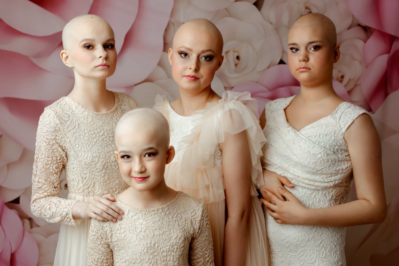 "Onko piękni". Niezwykła sesja z udziałem nastolatek, walczących z chorobą nowotworową