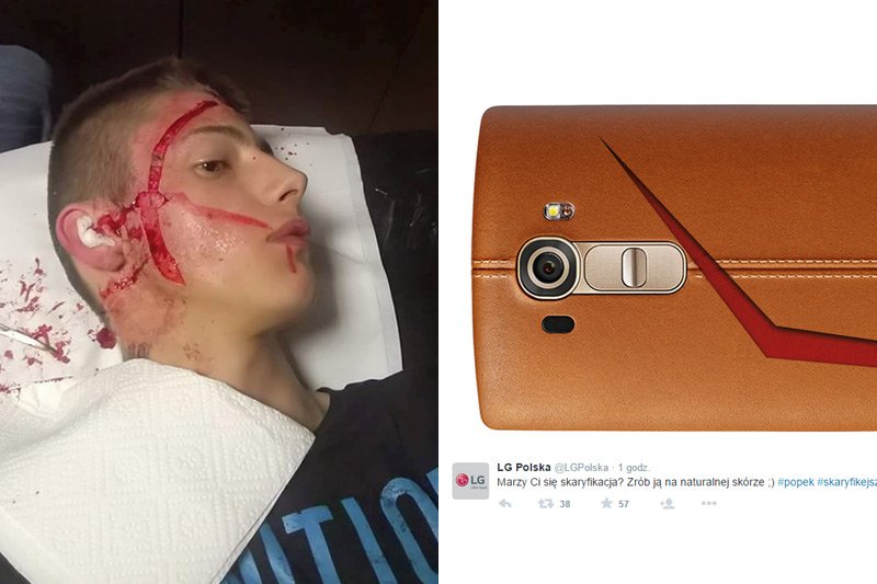 Marka wykorzystuje samookaleczenie Karola, który chciał upodobnić się do swojego idola, kontrowersyjnego showmana Popka z Gangu Albanii.