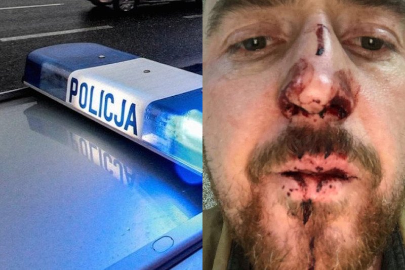 Aktor z Ukrainy pobity w Poznaniu.