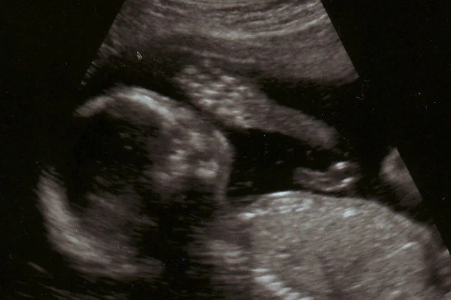 Aborcja jest legalna w Anglii, Szkocji i Walii do 24. tygodnia ciąży