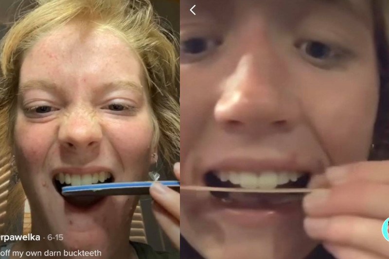 Nowy trend na TikToku – piłowanie zębów.