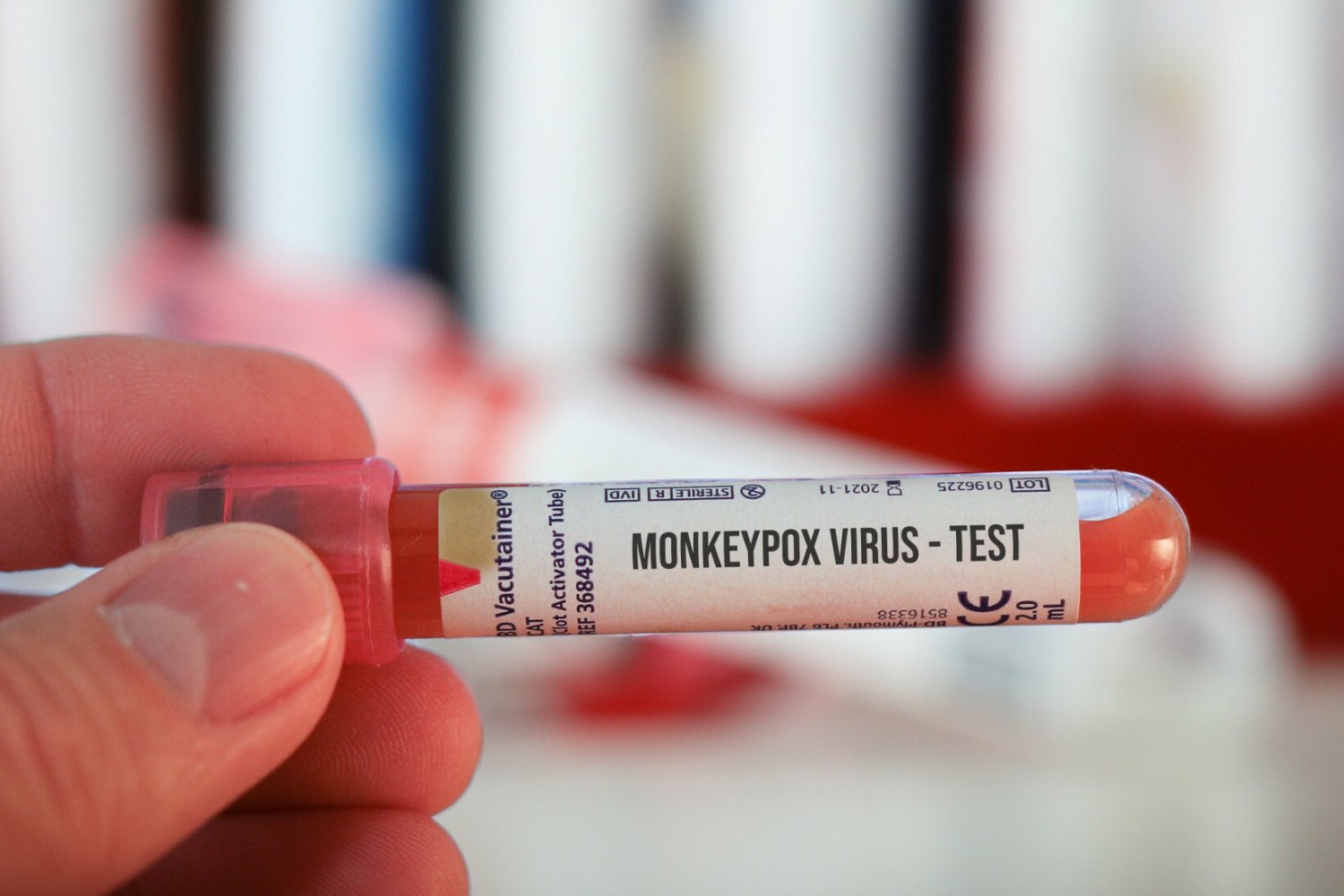 MZ wprowadza regulacja ws. małpiej ospy.