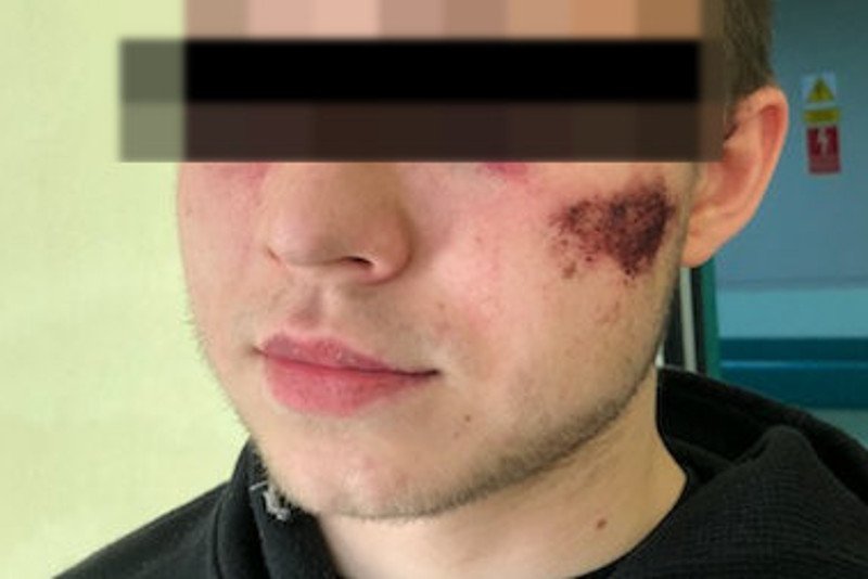 Trzech nastolatków twierdzi, że miało zostać pobitych przez pijanych policjantów. Funkcjonariusze tłumaczą, że to młodzież miała ich zaatakować.