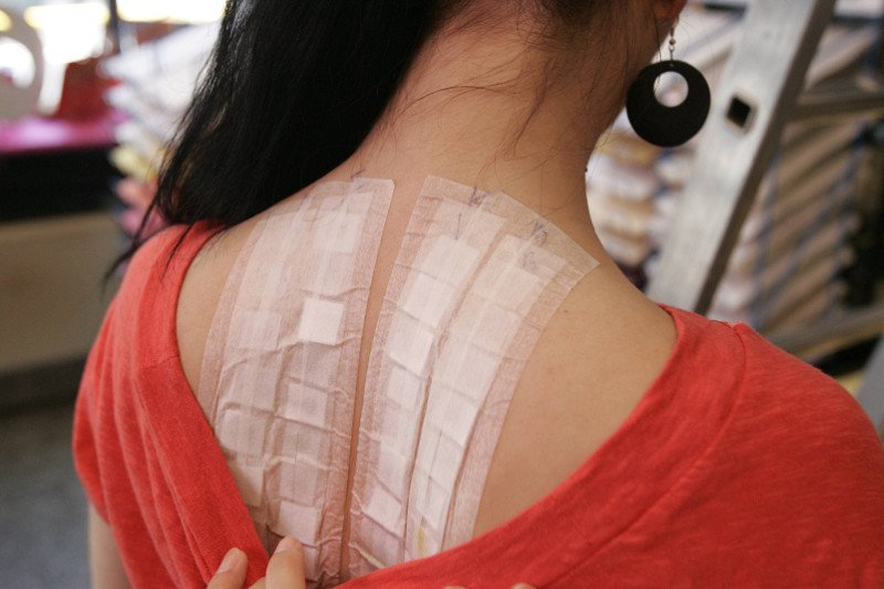 Na zdjęciu testy alergiczne.