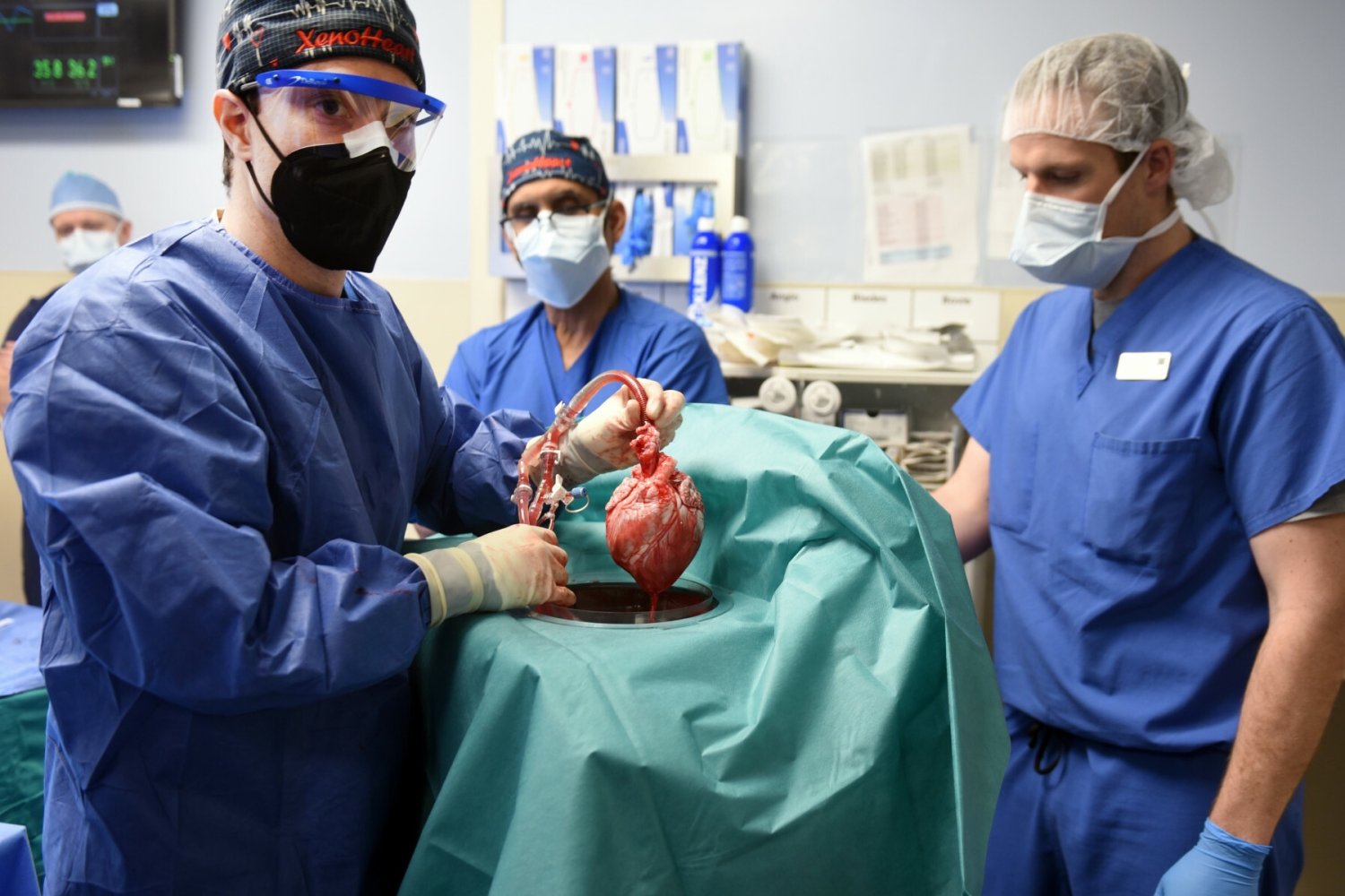 Zmarł pacjent z sercem po przeszczepie od świni.