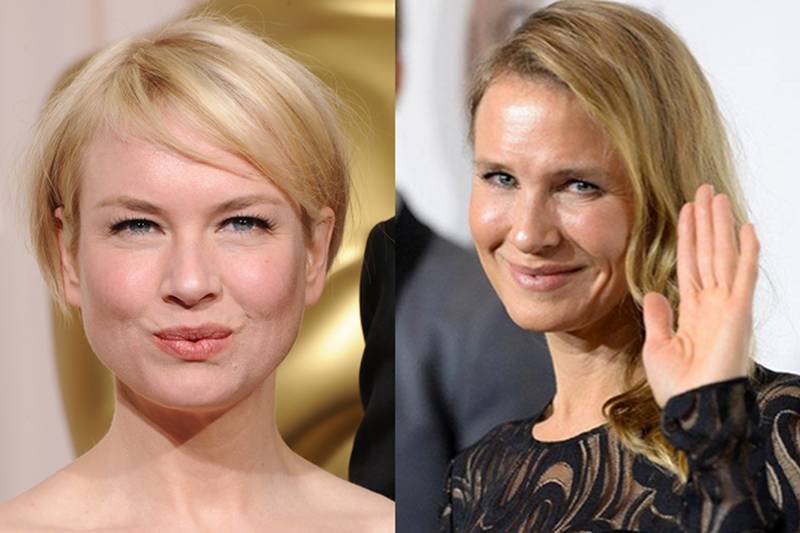 Twarz Zellweger uległa znaczącej zmianie.