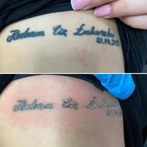 Wyznania miłosne jak się okazuje warto zachować w trochę innej postaci niż tatuaż...