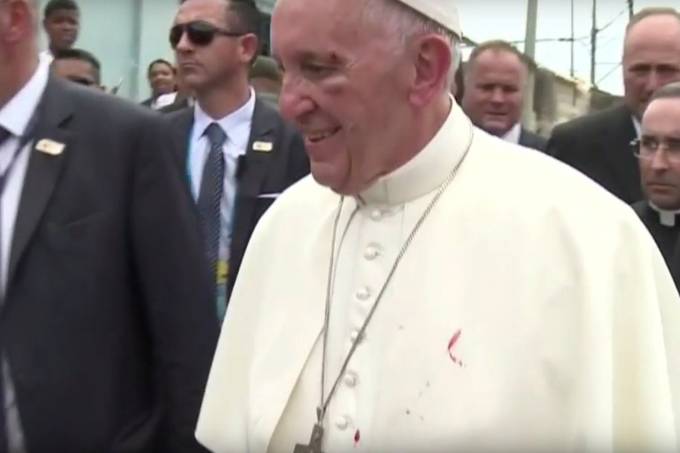 Papież Franciszek pomimo obrażeń nie stracił uśmiechu.